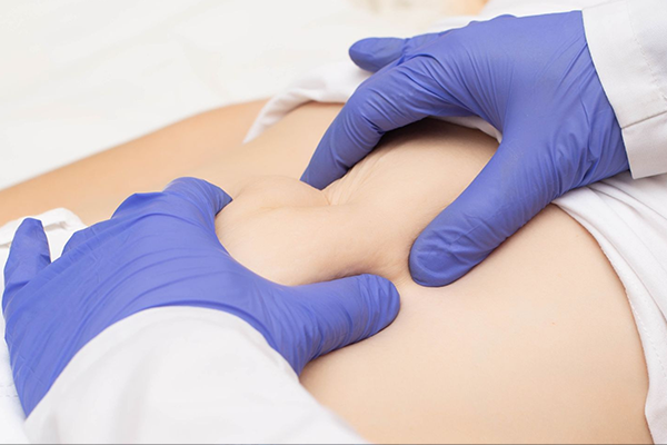 Abdominal Surgery