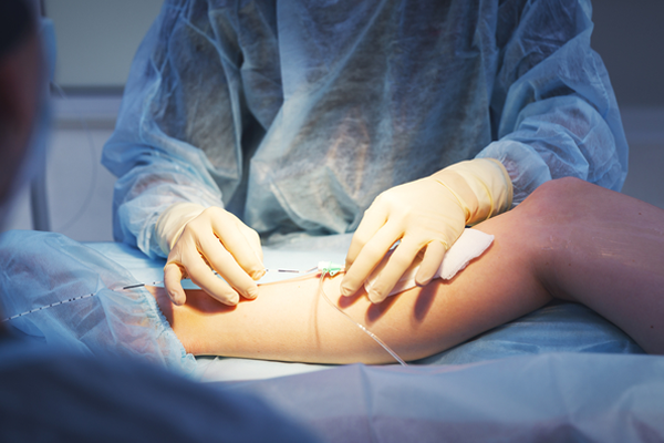 Vascular Surgery