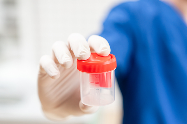 Genetic Testing