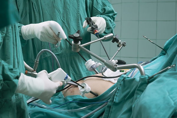 Bariatric Laparoscopy