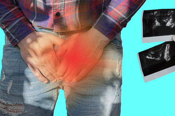 Urological Oncology