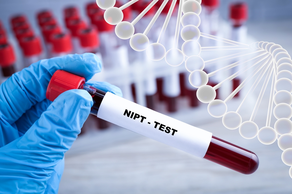 Prenatal Testing