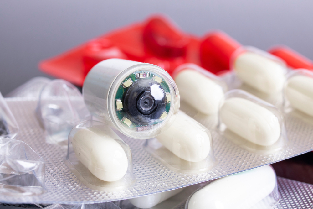 Capsule Endoscopy