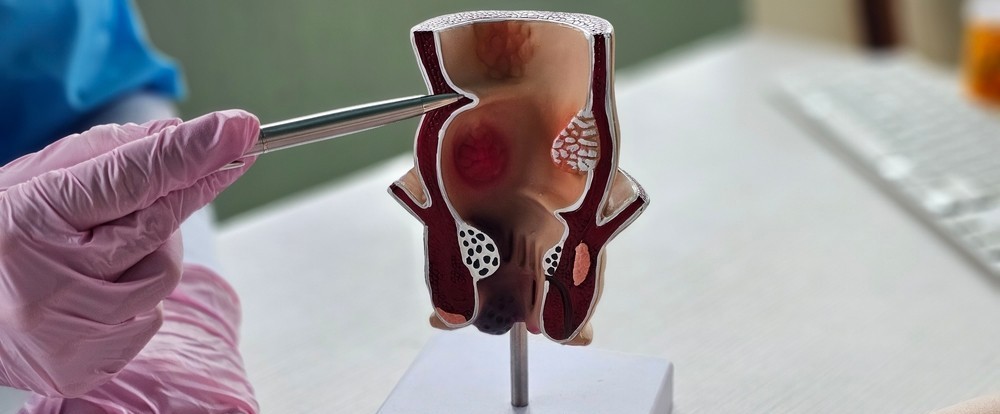 Colonoscopy