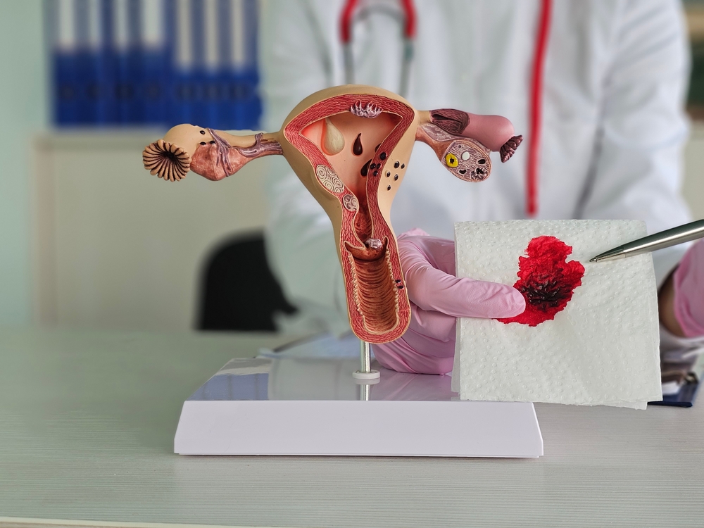 Abnormal Bleeding Management