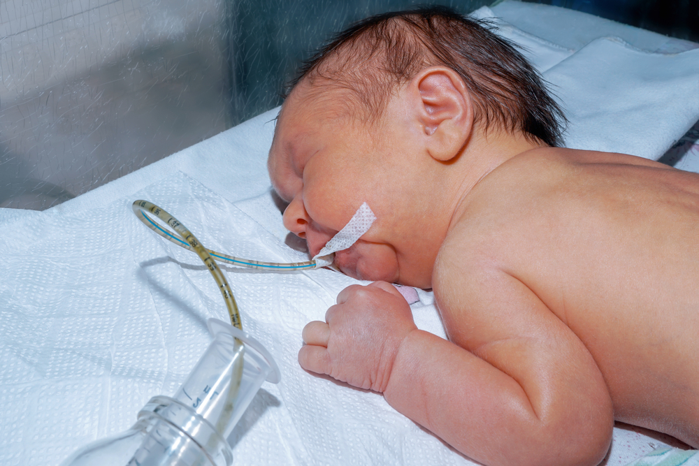 Neonatal Surgery Support