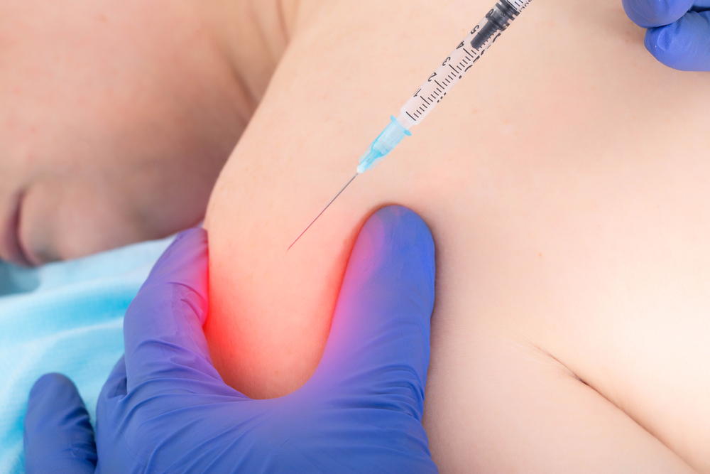 Nerve Block Therapy
